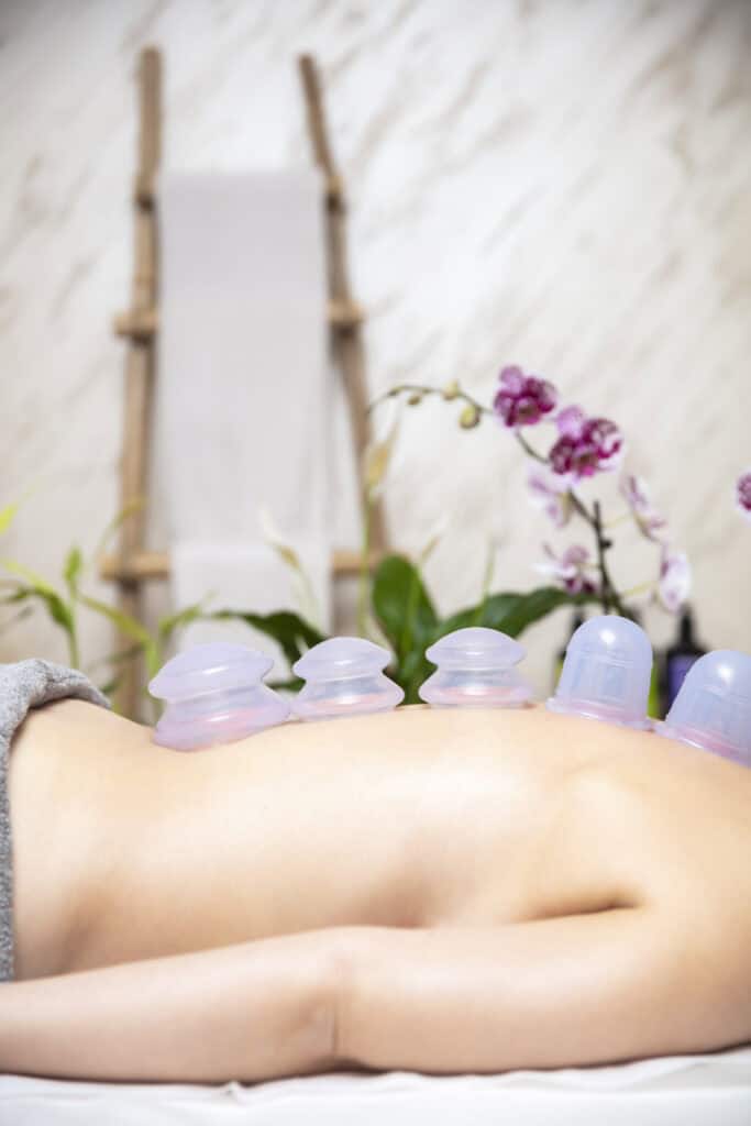 Cupping therapy session at Armonía Natural Massage.