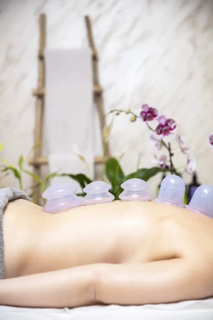 Cupping therapy session at Armonía Natural Massage.